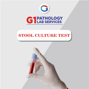 Stool Culture