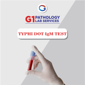 Typhi Dot IgM