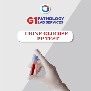 Urine Glucose PP