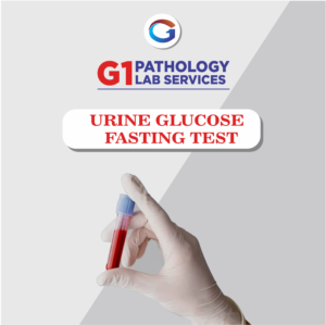 Urine Glucose Fasting Test