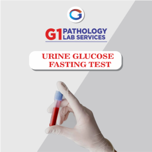 Urine Glucose Fasting Test
