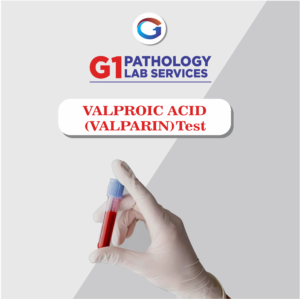 Valproic Acid Level