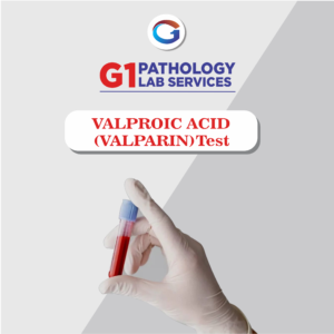 Valproic Acid Level
