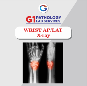 X-Ray Wrist AP/LAT