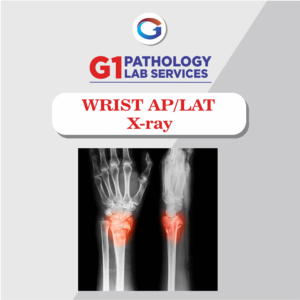 X-Ray Wrist AP/LAT