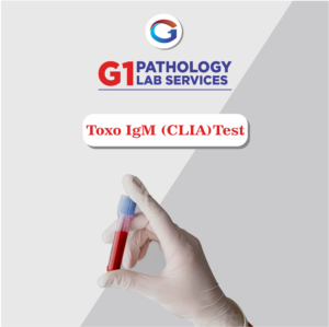 Toxoplasma IgM