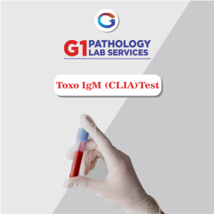 Toxoplasma IgM