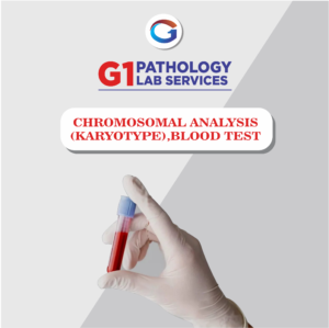 Chromosomal Analysis (Karyotype) Blood