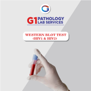 Western Blot Test (HIV 1, HIV2)