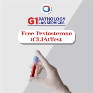 Free Testosterone