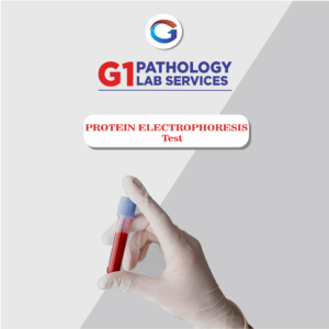 Protein Electrophoresis