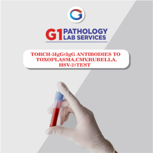 Torch-5 IgG (IgG Antibodies To Toxoplasma,Cmv,Rubella,HSV-2)