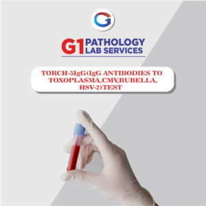 Torch-5 IgG (IgG Antibodies To Toxoplasma,Cmv,Rubella,HSV-2)