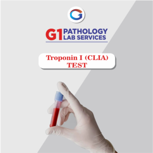 Troponin I