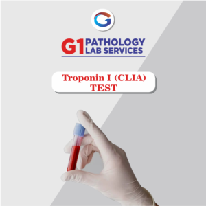Troponin I