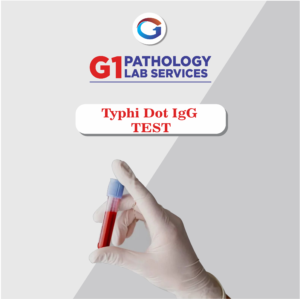 Typhi Dot IgG