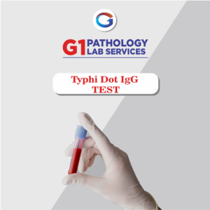 Typhi Dot IgG
