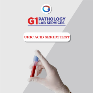 Uric Acid