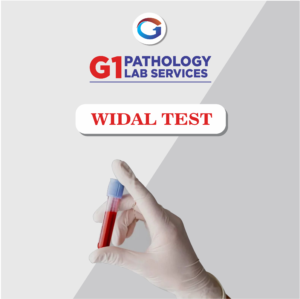 Widal Test