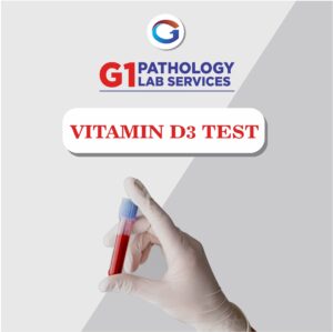 Vitamin D3